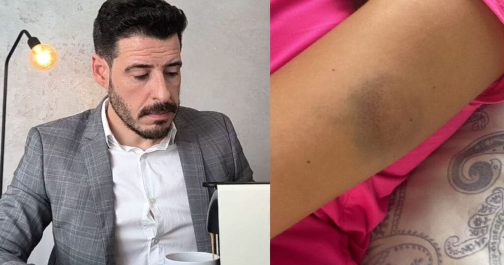 Título: Calvo Do Campari: Agressão Confessa Abalda Futuro Do Influencer