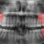 Crise No Vasco: Dívida Assusta E Ameaça Elenco