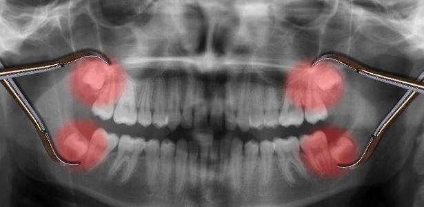 Crise No Vasco: Dívida Assusta E Ameaça Elenco